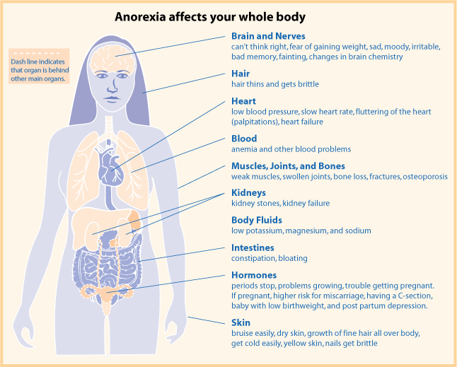 kā anoreksija ietekmē ķermeni